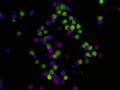 A. Witalisz-Siepracka | Leukämische Zellen (Grün) und Natürliche Killerzellen (Blau)