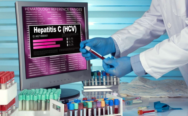 Hepatitis C